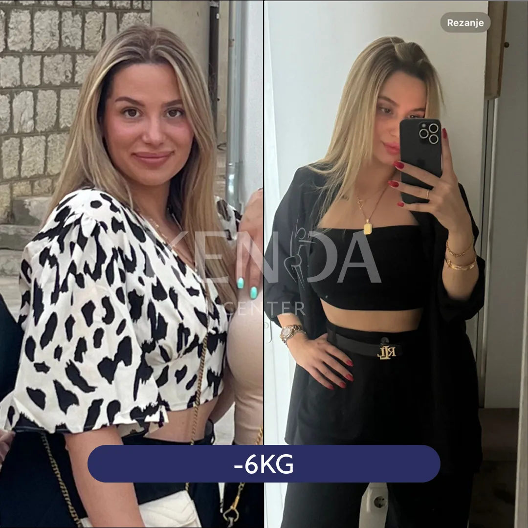Two side-by-side photos: a person in a patterned blouse, and taking a mirror photo in a black outfit.